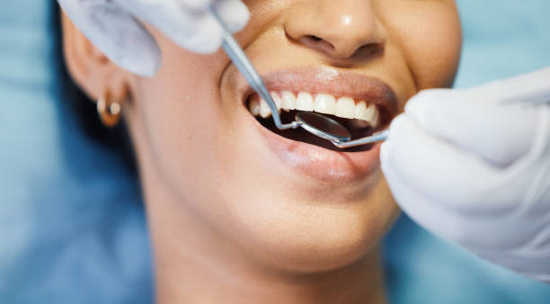 Best Urgent Tooth Repair  in Defiance, OH
